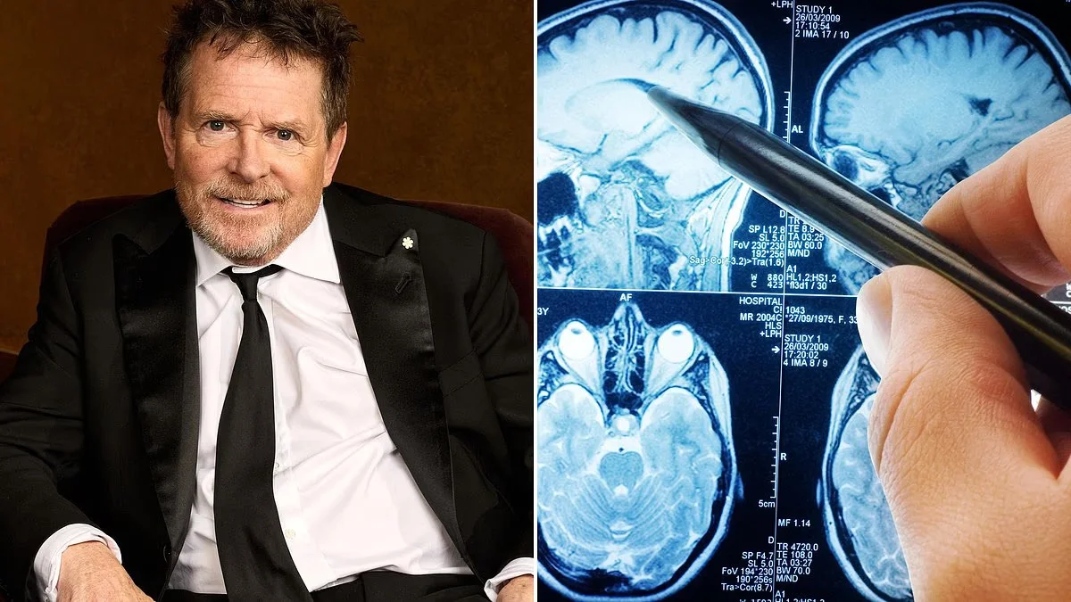 30-Second Tremor Test Could Flag Urgent Health Check