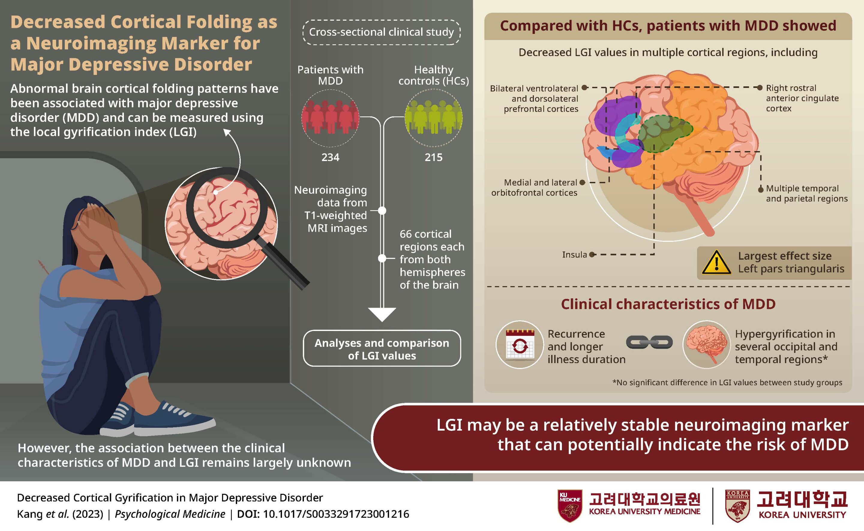 Featured image for "Groundbreaking Study Identifies Promising Biomarker for Major Depressive Disorder"