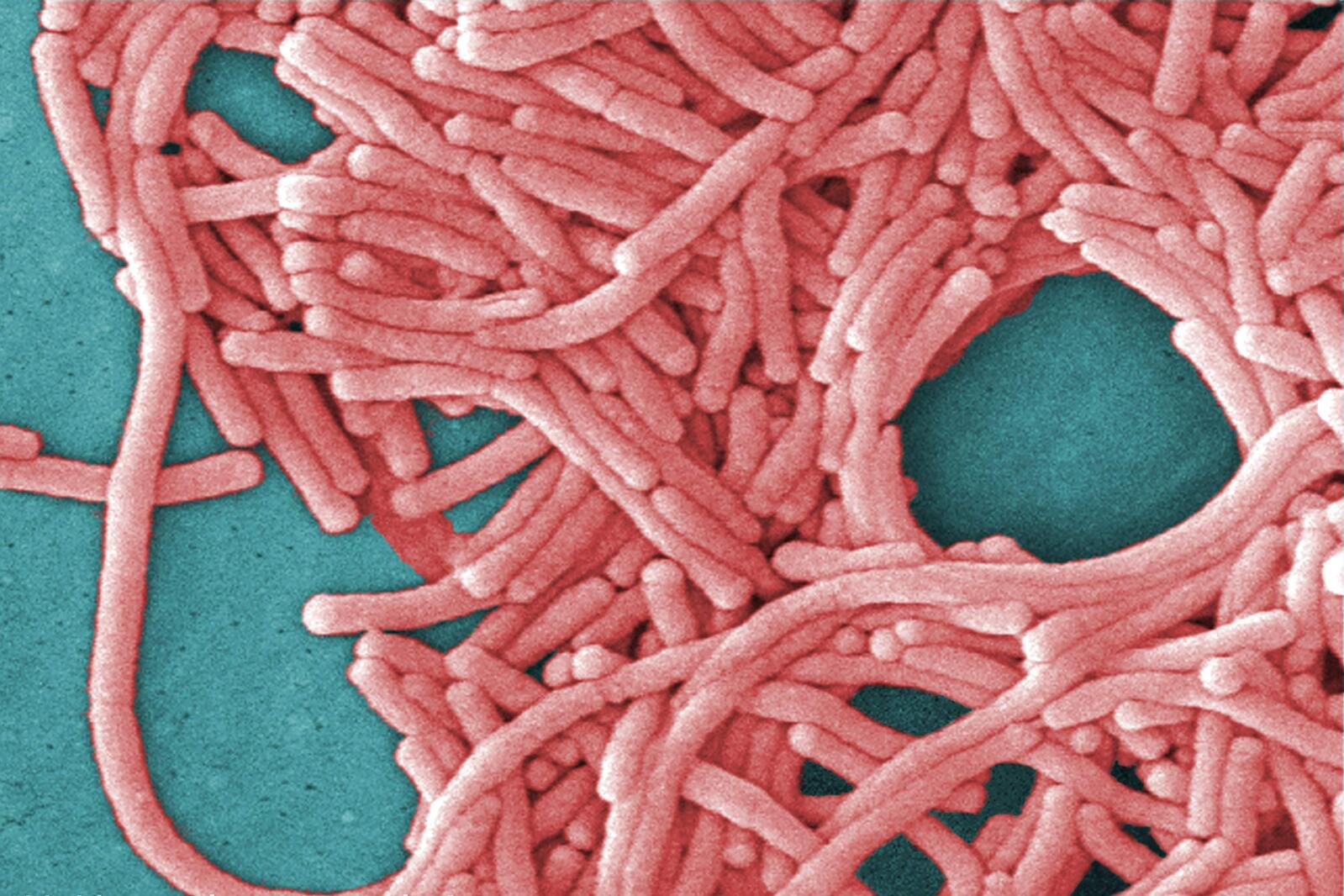 Featured image for Sonoma County Man Dies from Legionnaires’ Disease