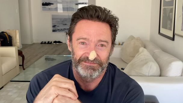 Hugh Jackman Urges Sunscreen Use After Skin Cancer Biopsies