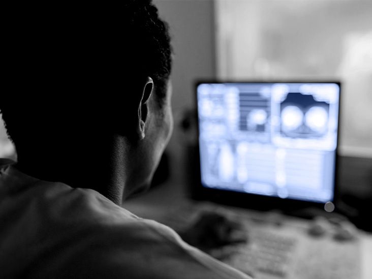 Featured image for PET Scans: A Promising Tool for Assessing Parkinson's and Lewy Body Dementia Risk