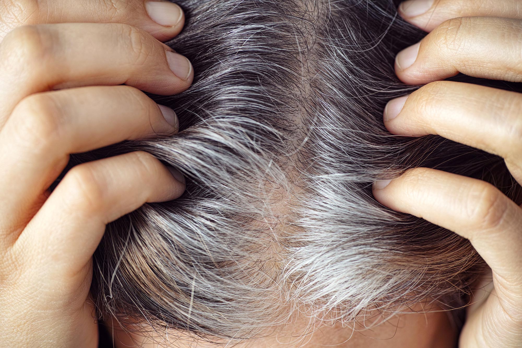 Featured image for Uncovering the Cause of Gray Hair: Stuck Stem Cells