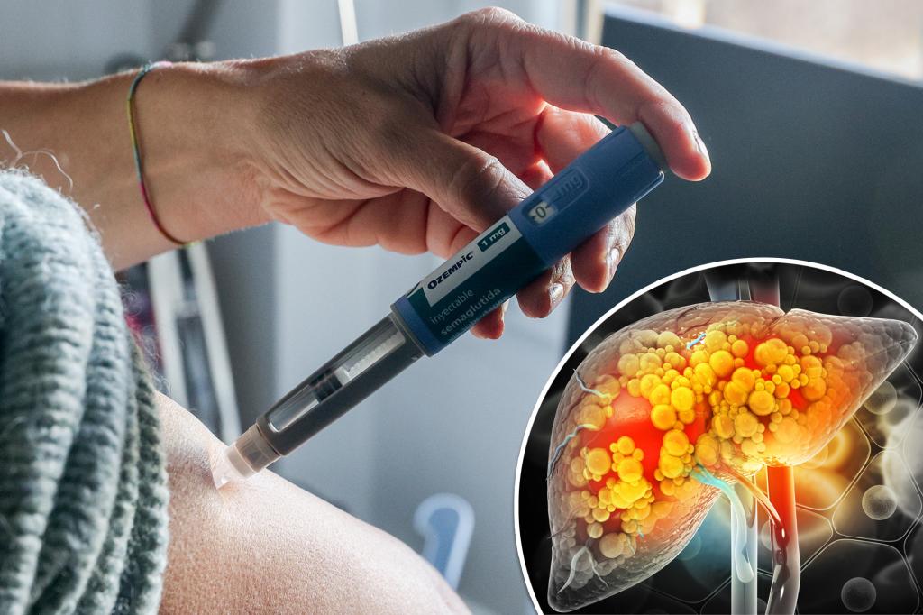 Featured image for "GLP1 Agonists: Promising for Reducing Liver Disease Risk in Diabetic Patients"