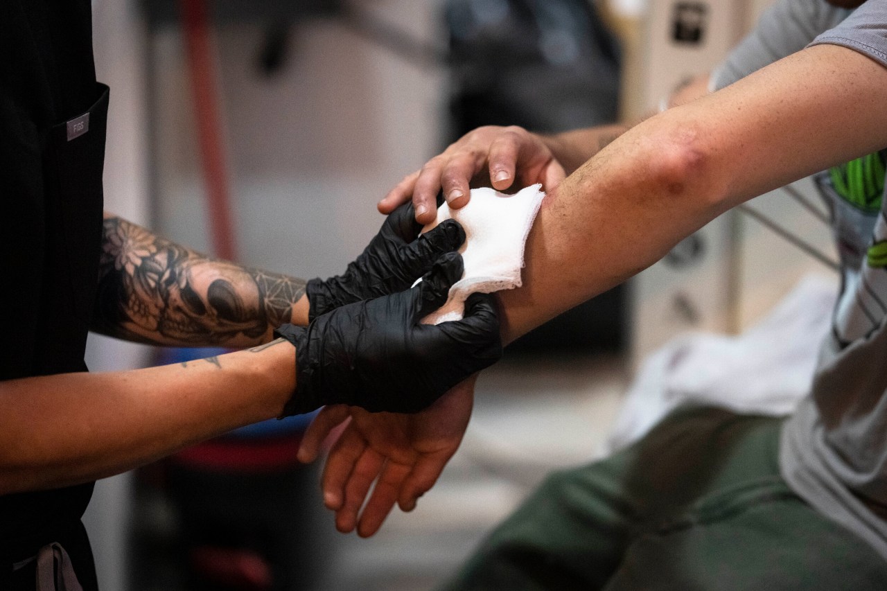 Featured image for Dangerous Skin-Rotting Sedative Found in Illegal Drugs in L.A. County