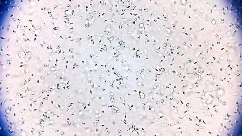 Featured image for European Sperm Donor with Cancer Risk Passes Mutation to 23 Children, Raising Reform Calls