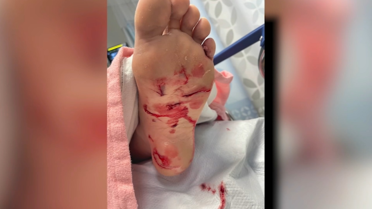 Shark attacks 15-year-old surfer at Jersey Shore.