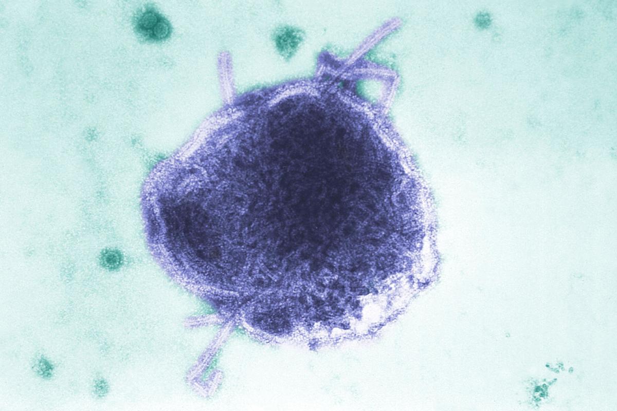 Rising Measles Outbreaks and the Impact of Vaccine Skepticism