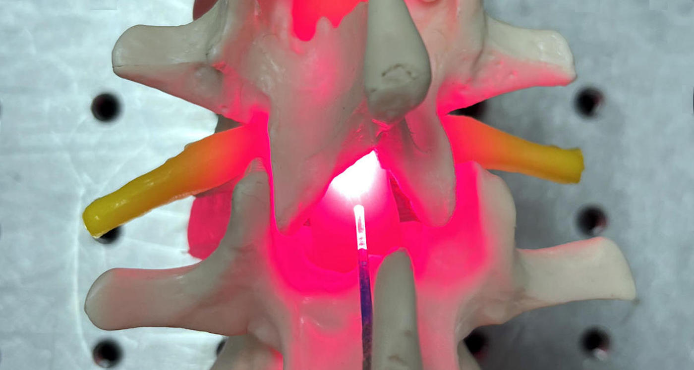 Featured image for Breakthrough Devices Offer Hope for Spinal Cord Injury Recovery