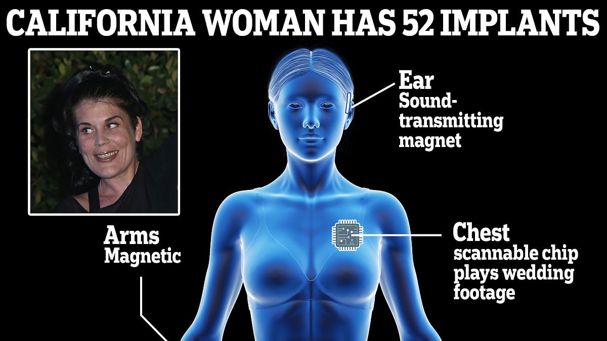 Featured image for "The 'World's Ultimate Cyborg': California Woman with 52 Implants Plans for More"