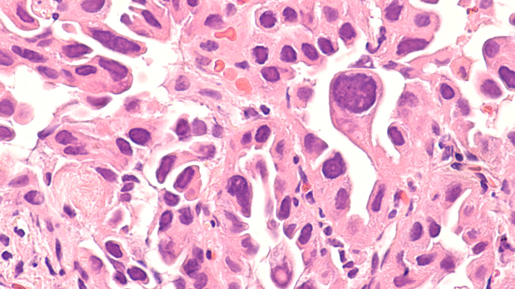 Rethinking Cancer Naming: The Case for Genetic-Based Classification