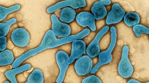 Marburg Virus Outbreak: What You Should Know