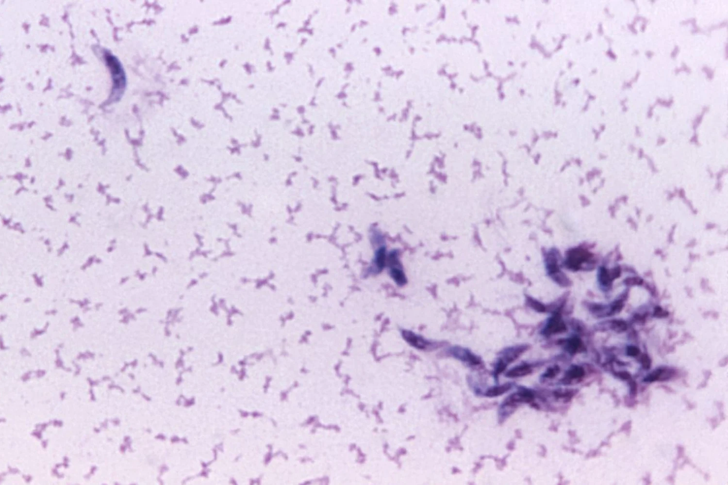 Featured image for Common Parasite May Significantly Reduce Male Fertility by Destroying Sperm