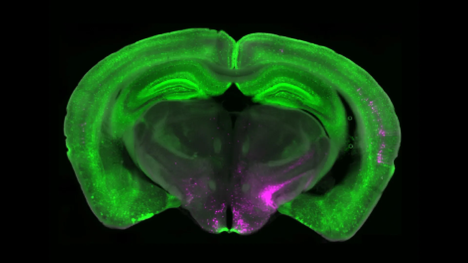 Featured image for Brain Circuit Identified as Key to Turning Off Chronic Pain