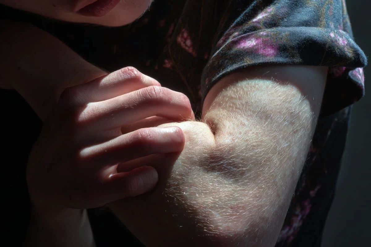 Touch-neuron TRPV4 acts as the brain’s stop-scratching brake