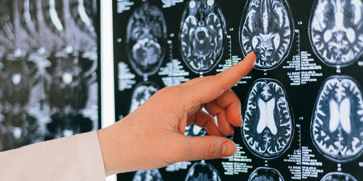 Featured image for "Brain-Damaging Foods: Which Snacks to Avoid and Why"