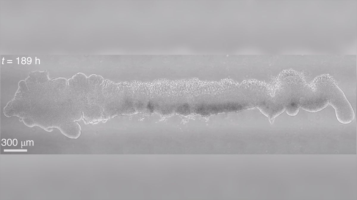 "Lab-Grown Mini Model Mimics Early Human Central Nervous System"