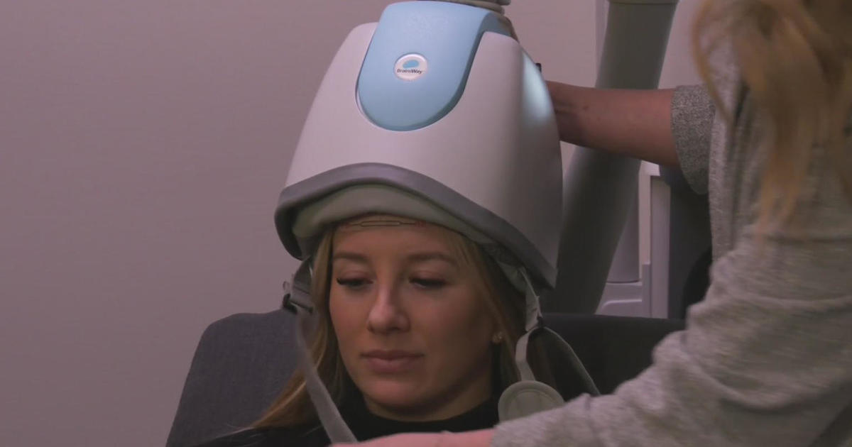 Featured image for "Revolutionizing Depression Treatment: The Power of Transcranial Magnetic Stimulation"