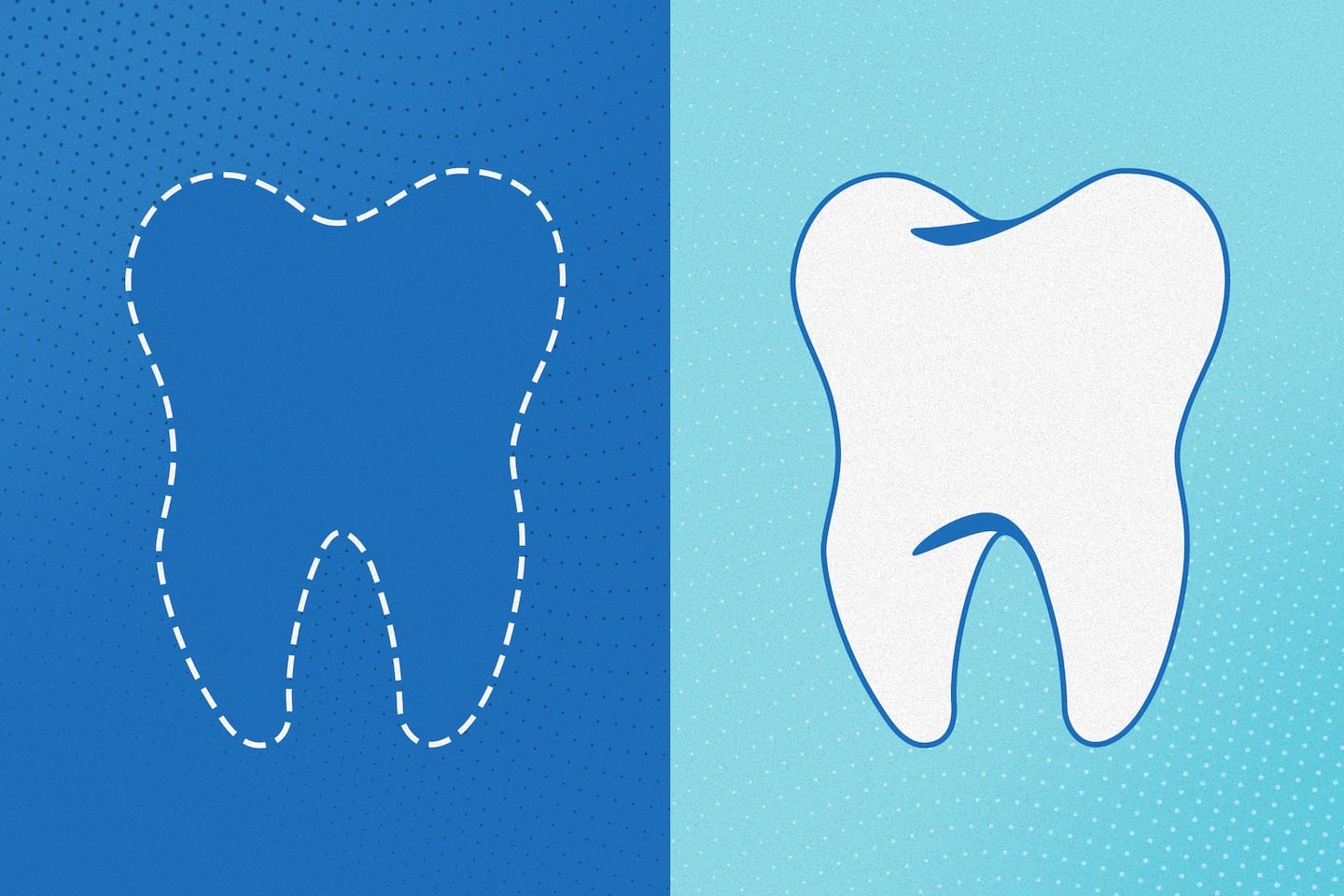 Featured image for Controversy Surrounds Wisdom Tooth Extraction: Is it Really Necessary?