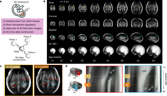 Unveiling the Intricate Brain: Mapping Development, Speech, and Cellular Landscape