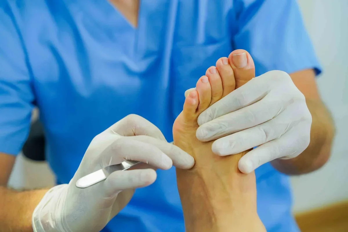 "Top Plantar Fasciitis Treatments for Quick Relief"