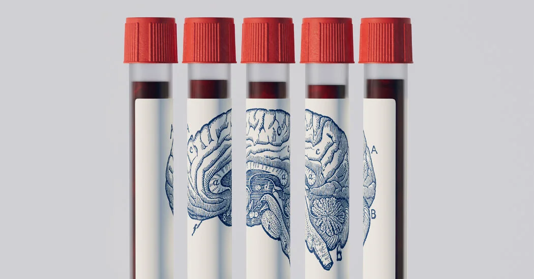 New Blood Tests Could Flag Alzheimer's Risk Years Before Symptoms