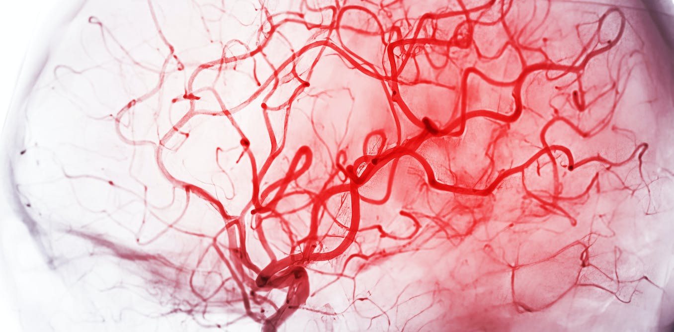 Featured image for The Brain's Supply Chain Challenges: Neurons Make Do with Limited Blood Flow.