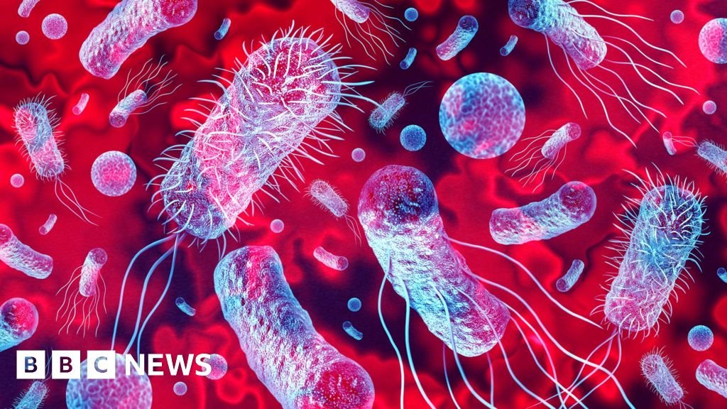 Deadly Listeria Outbreak Triggers Major Meat Recall Across US