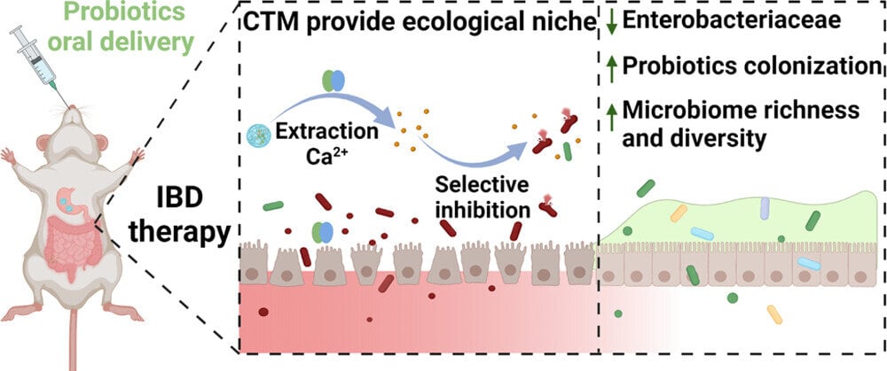 Featured image for Revolutionary Treatment: Gut Bacteria Drug for IBS and Arthritis