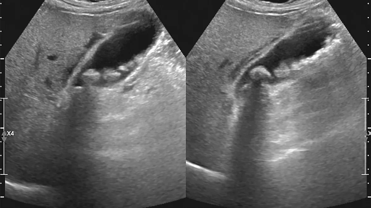 Featured image for Microplastics in Human Fluids and Waterways Pose Rising Health Risks