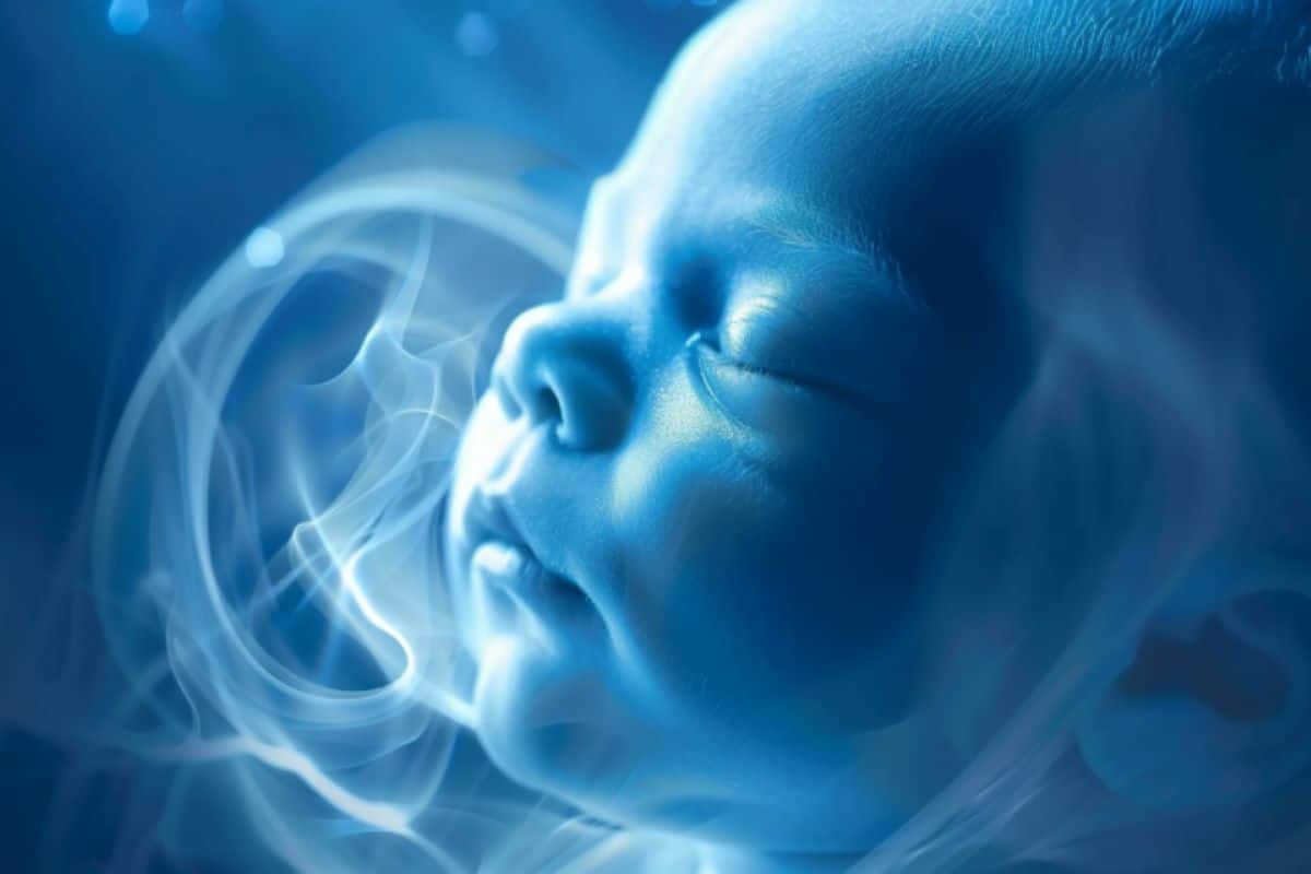 Fetal Brain Overgrowth Tied to Autism Severity