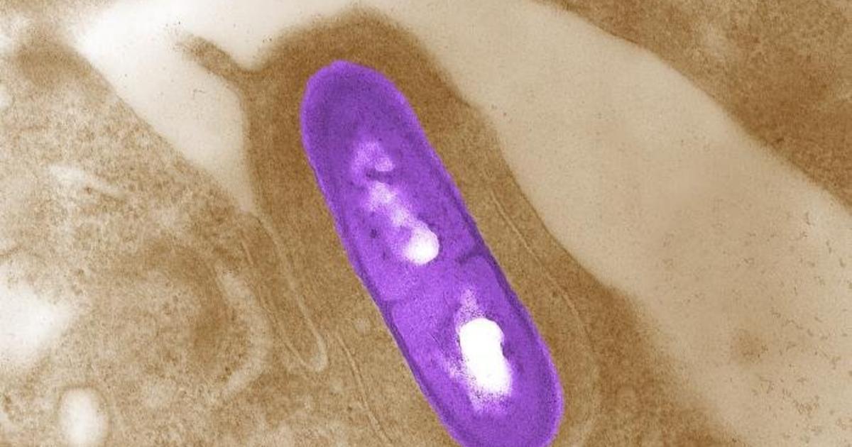 Featured image for "Listeria Outbreak Triggers Product Recalls at Major Retailers"