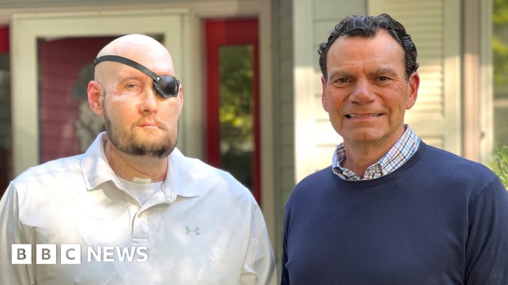 Featured image for Groundbreaking Eye Transplant Gives US Veteran New Hope