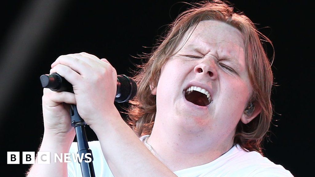 Featured image for Lewis Capaldi's Touring Break for Mental and Physical Health Amid Tourette's Struggle