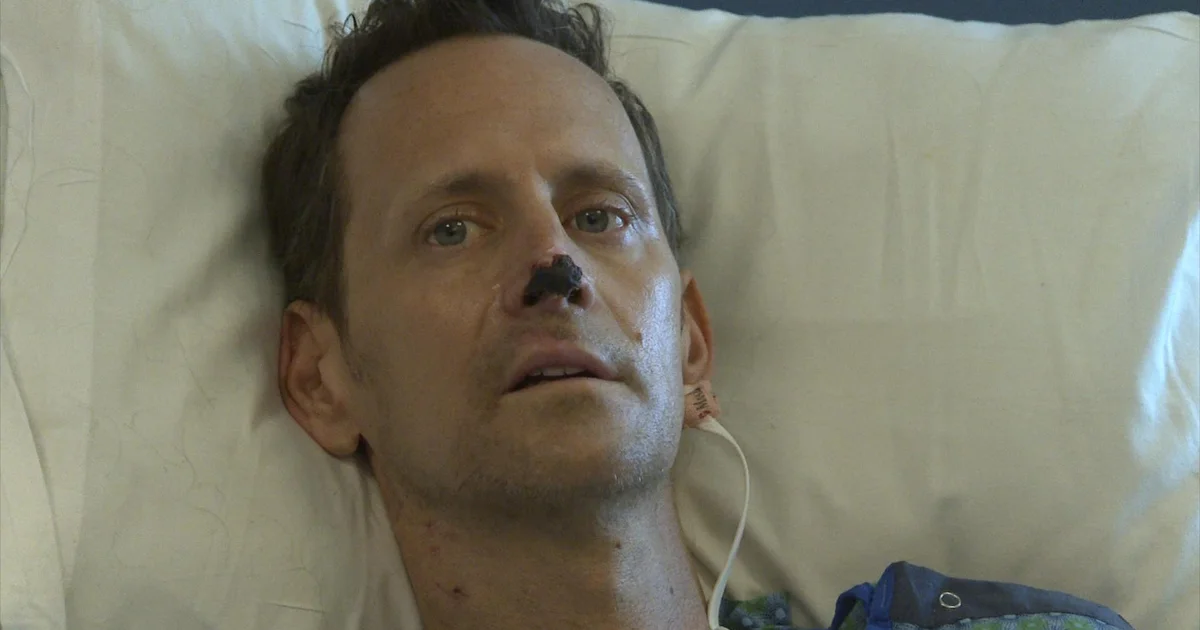 Flu Complications Result in Life-Threatening Sepsis and Amputations for Boulder Man