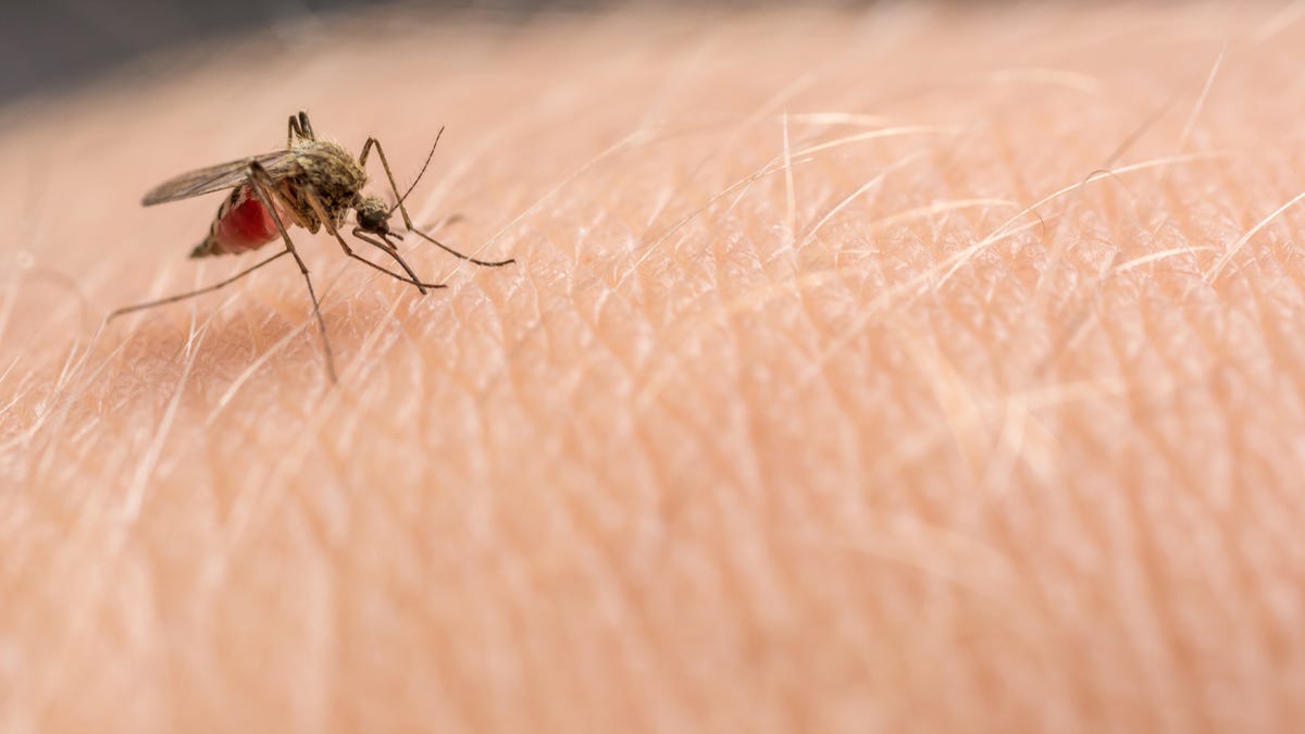 Malaria Resurfaces in US After Nearly Two Decades