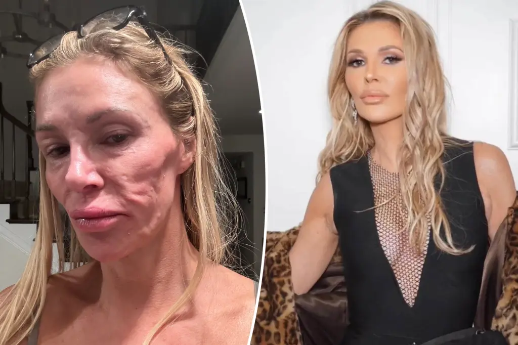Featured image for Brandi Glanville's Shocking Facial Transformation Blamed on Parasite