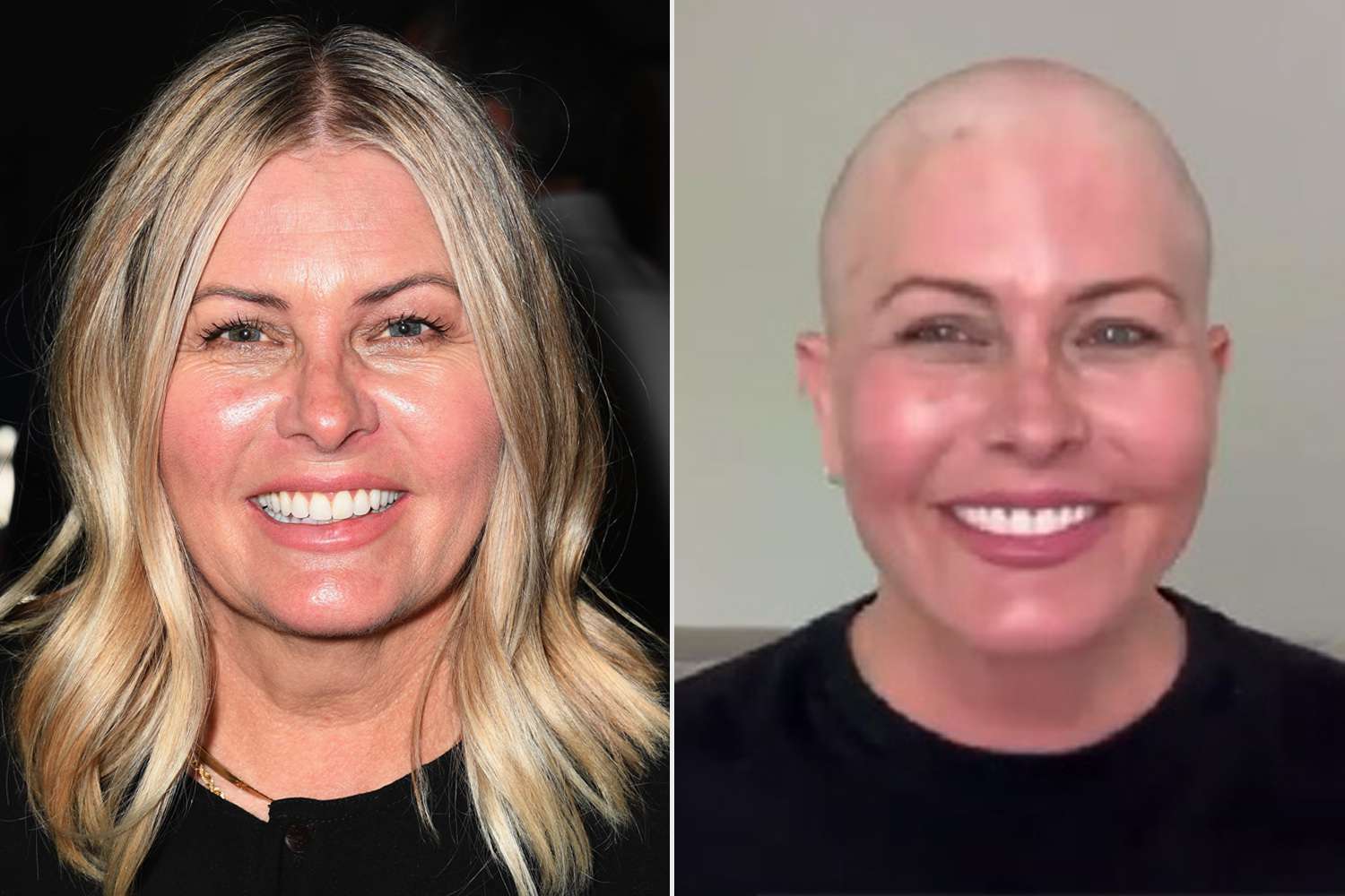 Featured image for "Baywatch Star Nicole Eggert Shaves Head Amid Breast Cancer Battle"