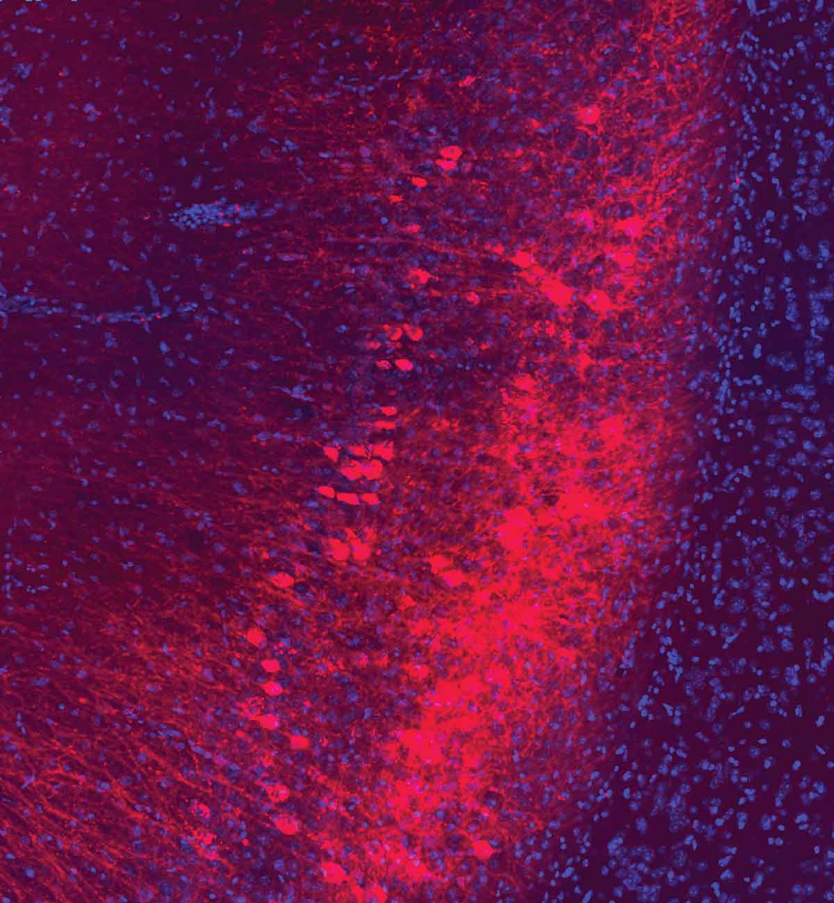 How Stress Alters Brain Reward Pathways and Affects Joy