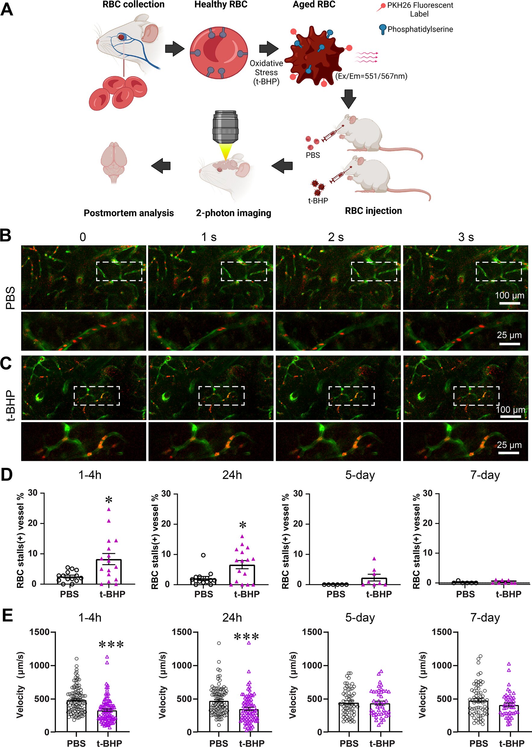 Featured image for Breakthrough Discovery: Uncovering the Hidden Cause of Brain Hemorrhages