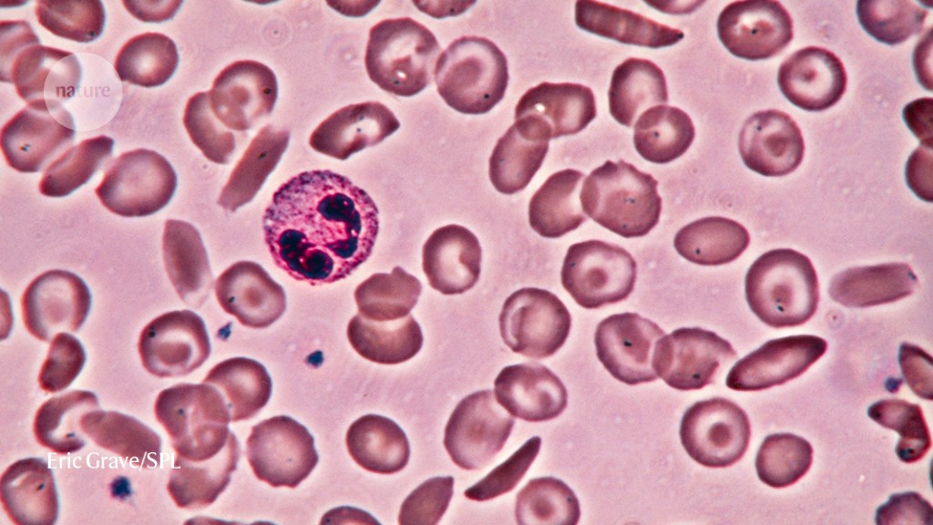 Navigating the Intersection of Gene Therapy and Drug Pricing.