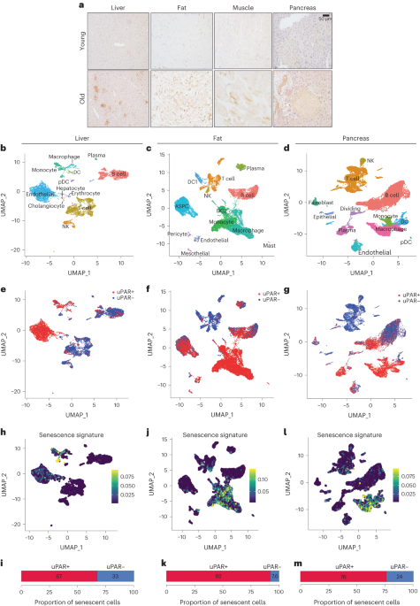 Featured image for "Senolytic CAR T Cells: Unlocking the Fountain of Youth for Age-Related Metabolic Dysfunction"