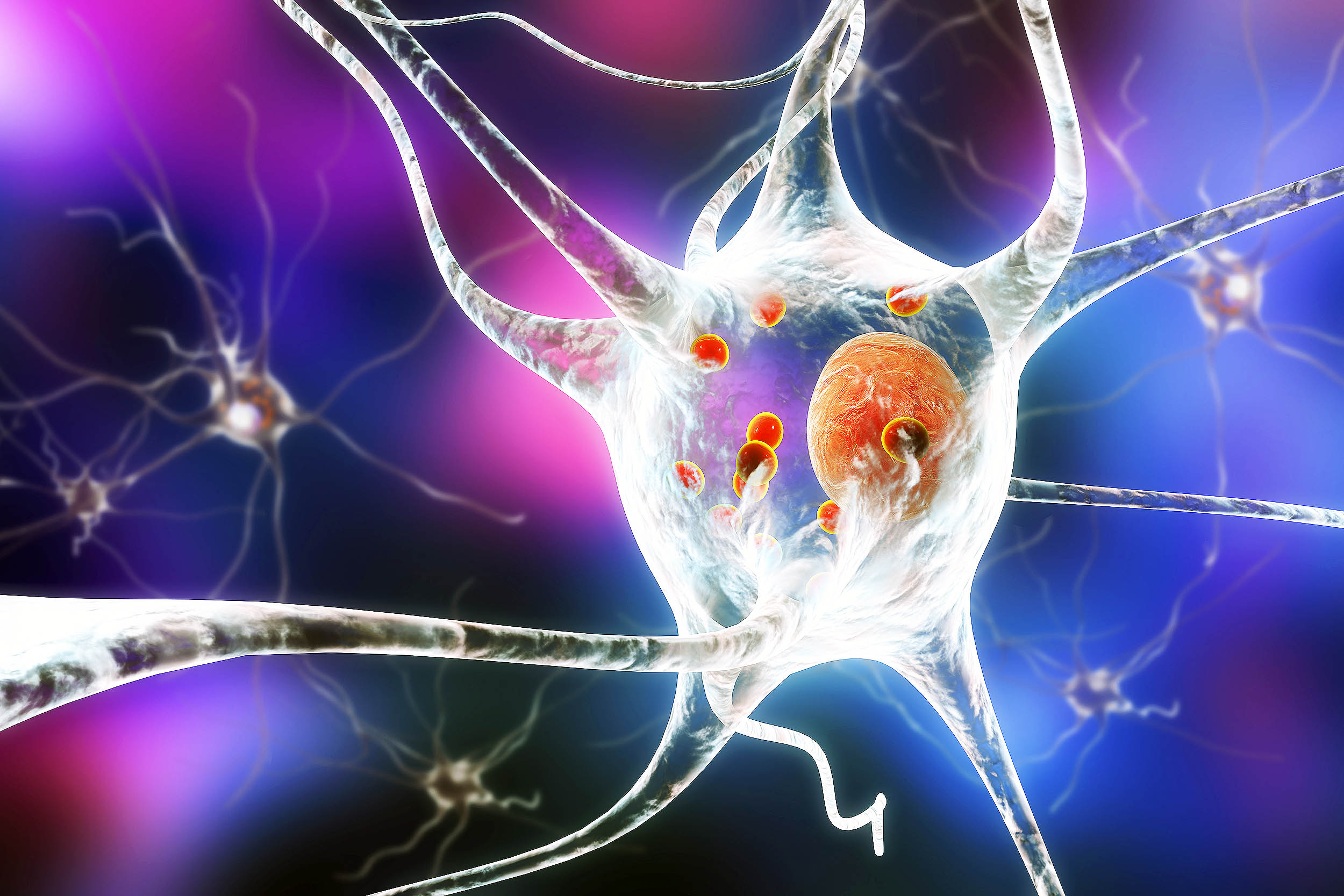 Featured image for Cancer Drug Shows Promise in Slowing Parkinson's Disease