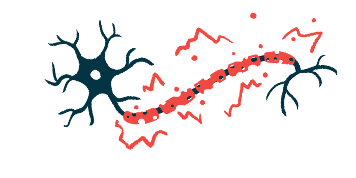 Featured image for Microglia Activation Linked to Nerve Damage in MS