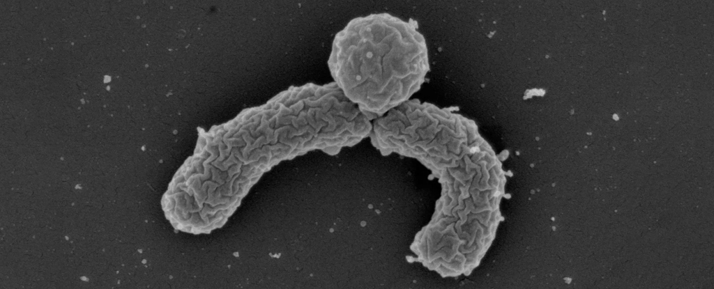 Featured image for Scientists Uncover Powerful Compound that Outsmarts Antibiotic Resistance