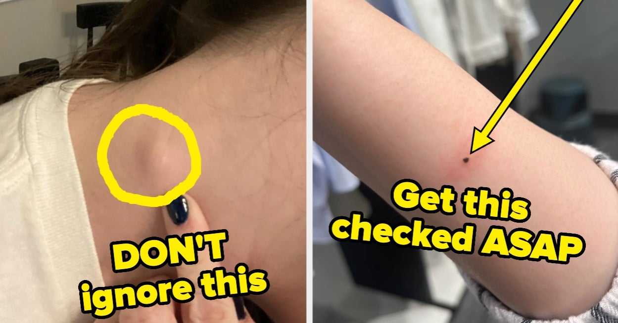 Featured image for Cancer Survivors Share Warning Signs Not to Ignore