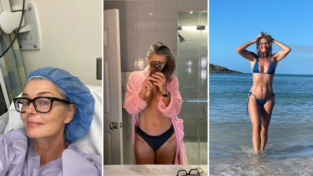 Featured image for "Paulina Porizkova Opens Up About Double Hip Replacement Surgery and Scars in Revealing Snap"