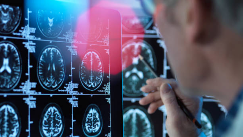 Featured image for Over-the-Counter Supplement Boosts Brain Health in Seniors