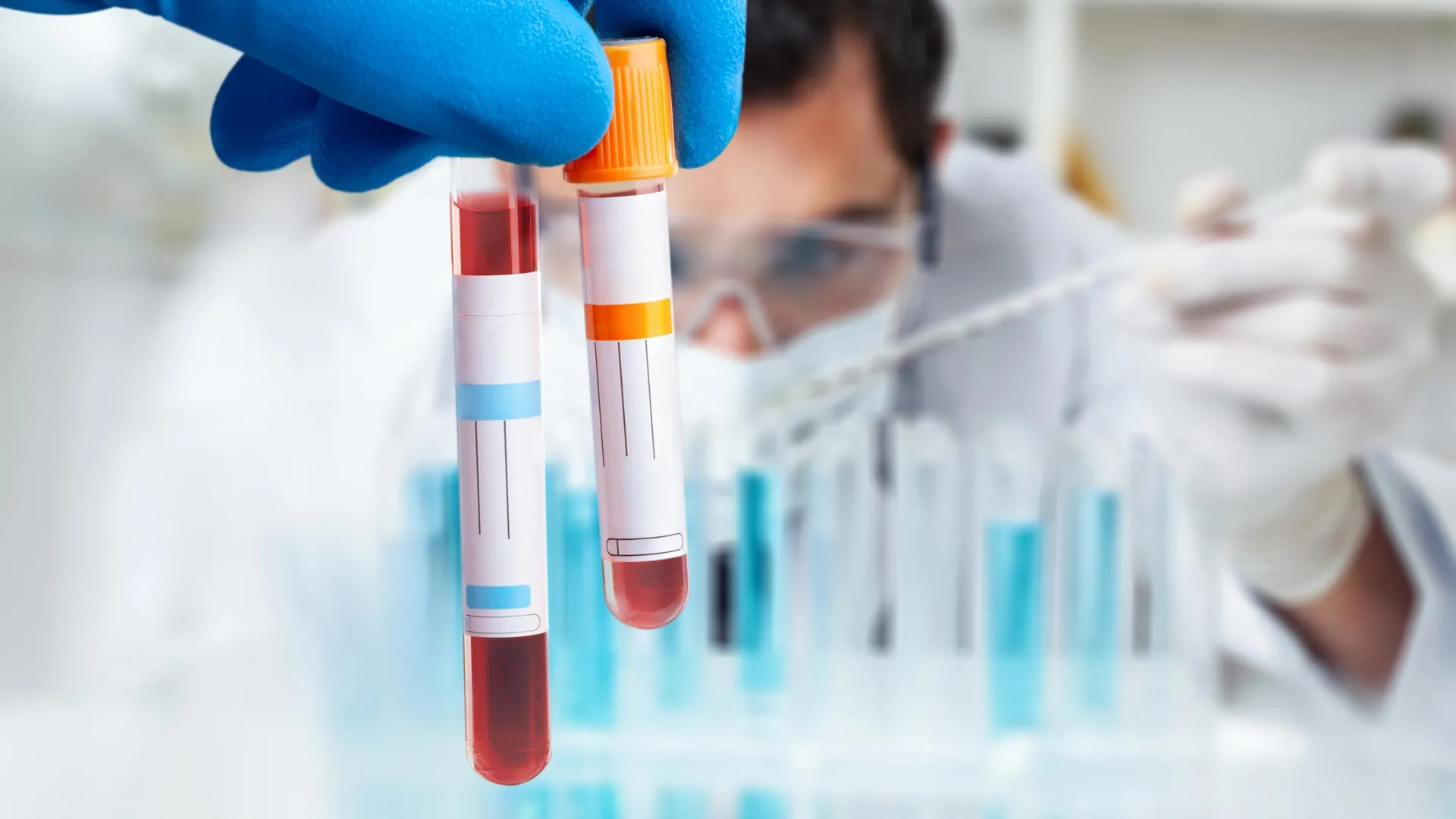 Featured image for Blood Test Confirms Chronic Fatigue Syndrome