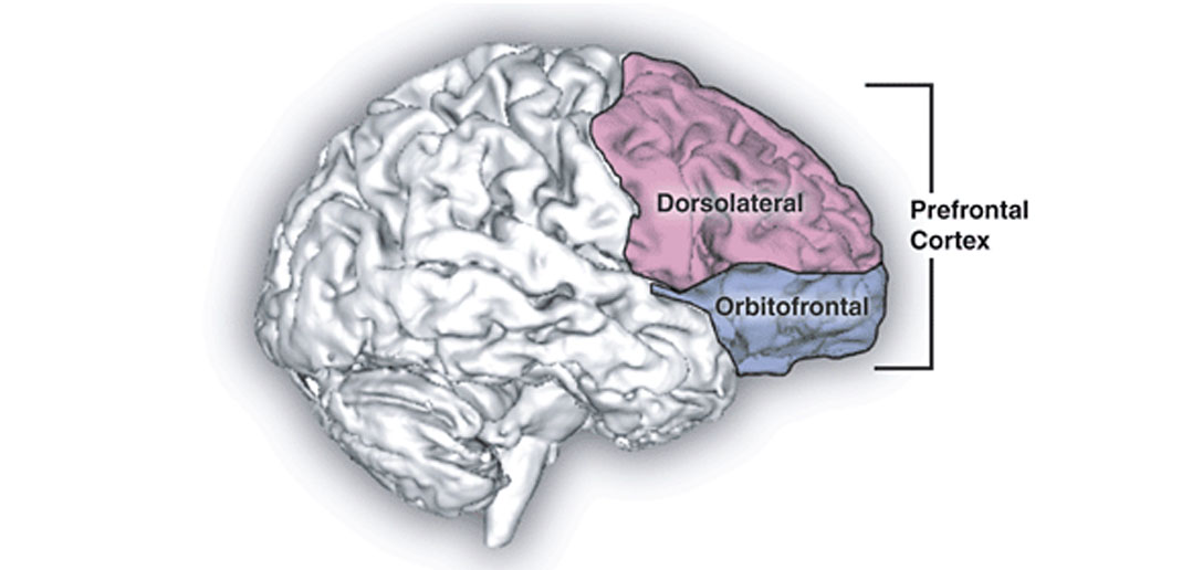 Featured image for "Linking Childhood Adversity to Adult Depression Through Orbitofrontal Cortex Thinning"
