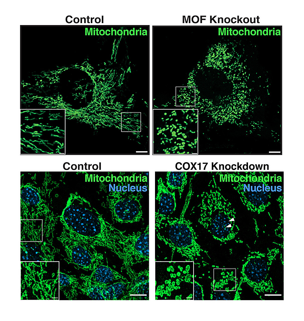 Featured image for "MOF: The Epigenetic Regulator Fueling Mitochondrial Metabolism, Reveals Study"